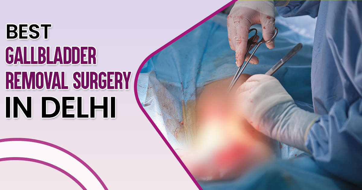 Best Gallbladder Removal Surgery in Delhi, India