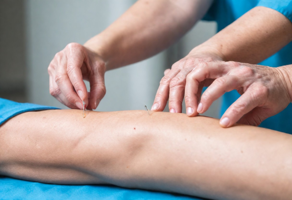 Finding Your Perfect Match: Dry Needling vs. Acupuncture for Optimal Results