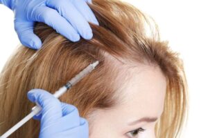 Understanding Female Hair Transplant in Dubai