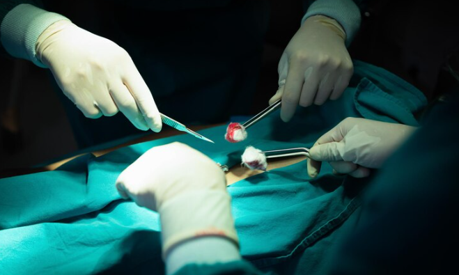 Title: Experience the Best Gastric Sleeve Surgery in Delhi