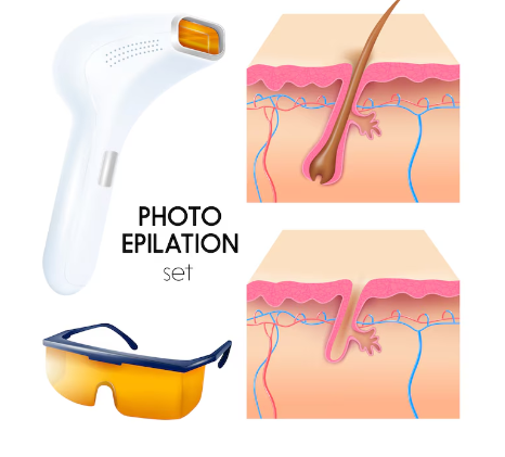 Permanent hair removal in Indirapuram: It's Not as Difficult as You Think,