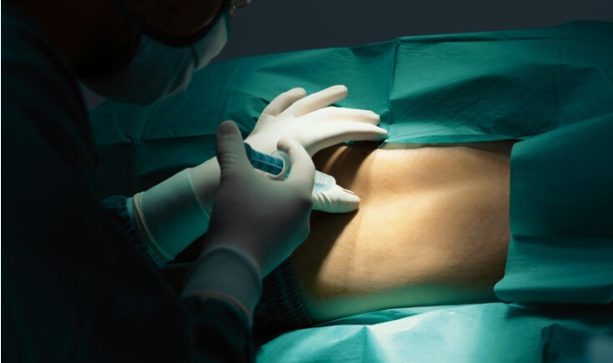 Best Gastric Sleeve Surgery in Delhi with Dr Tarun MIttal