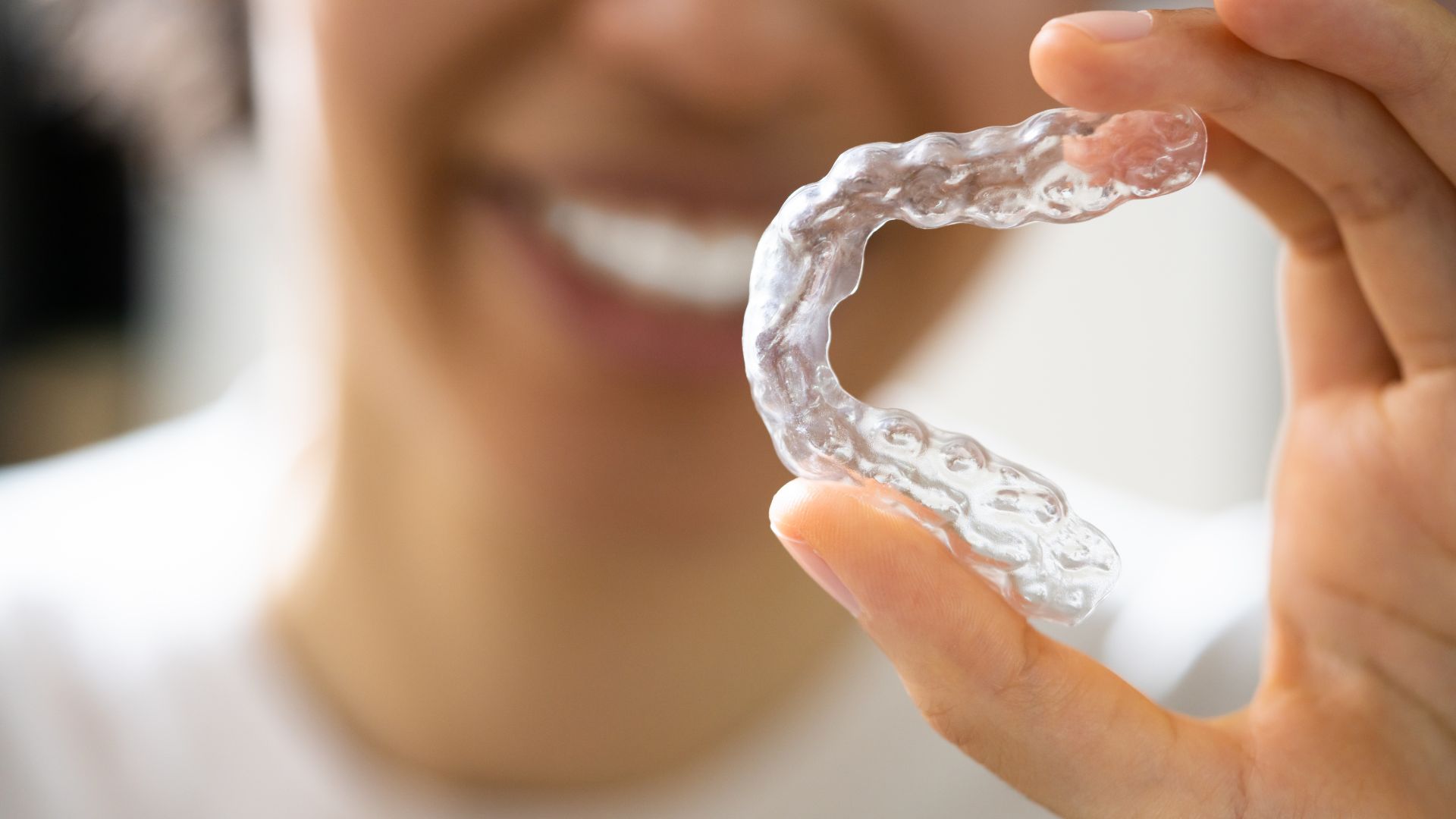 dental-clear-aligners
