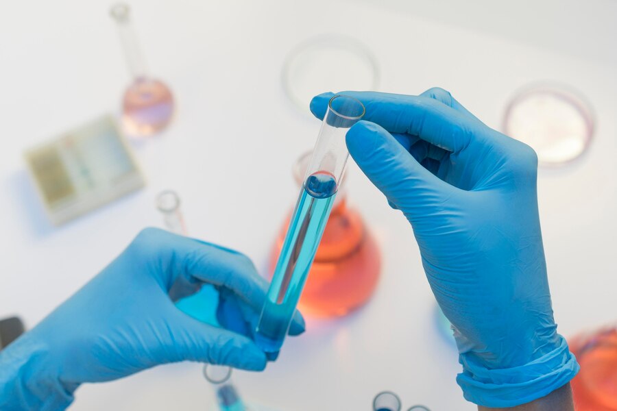 Nucleic Acid Amplification Testing