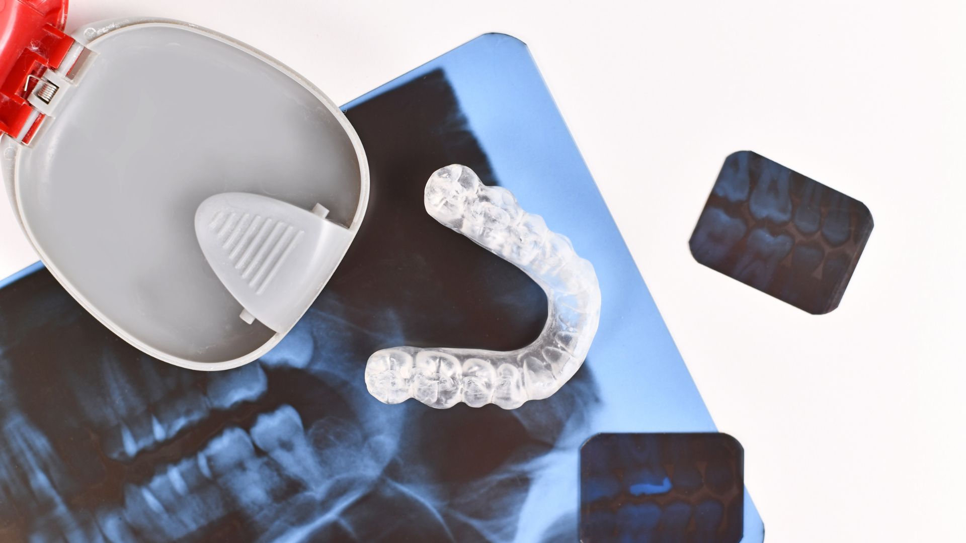 understanding-dental-misalignments