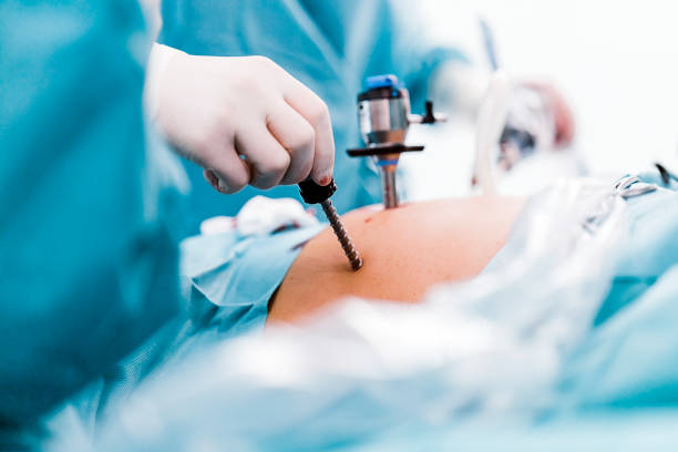 bariatric surgery in Abu Dhabi