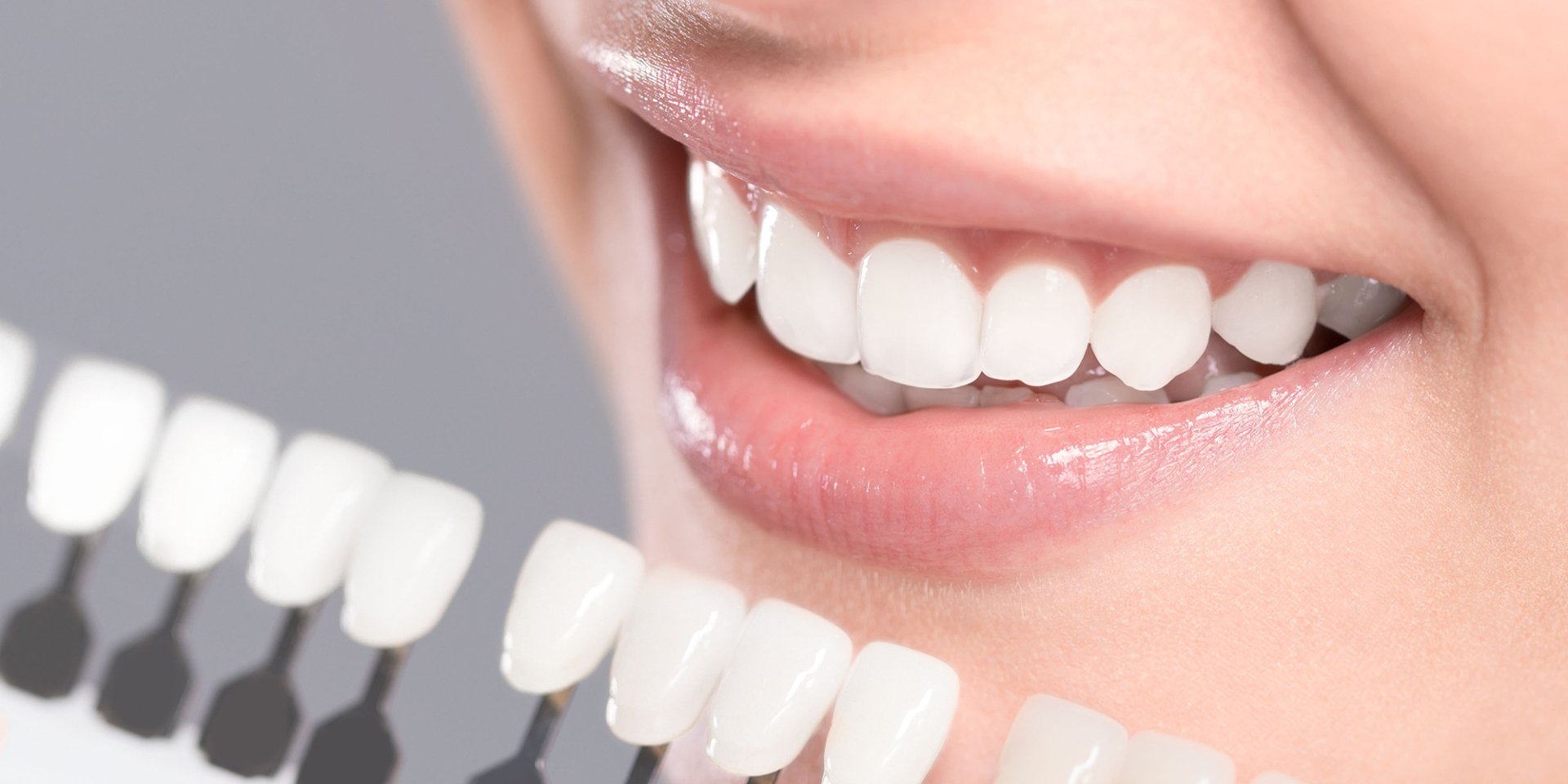 Dental Veneers in Nagpur