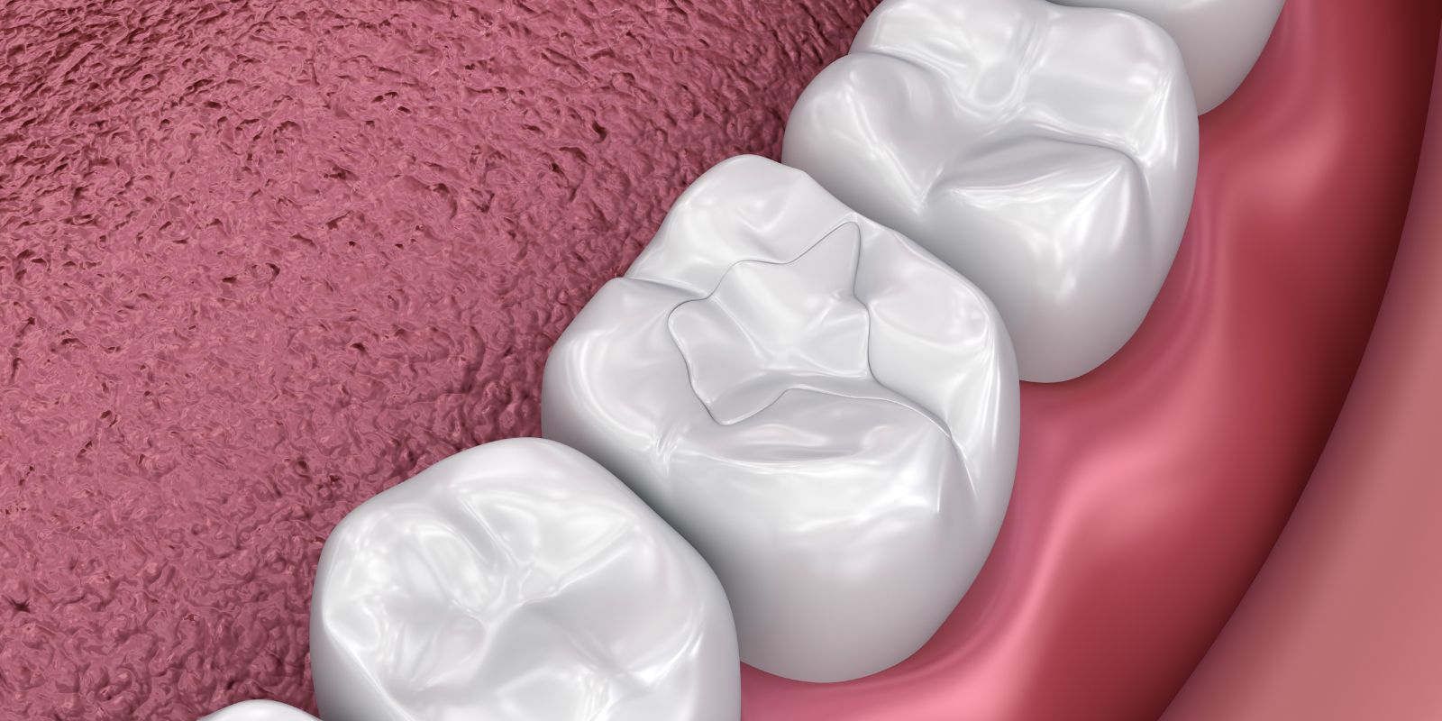 Kids Dental Clinic Chembur