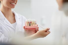 dental implants in sambalpur