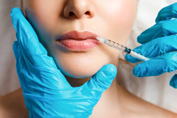 lip fillers in Abu Dhabi