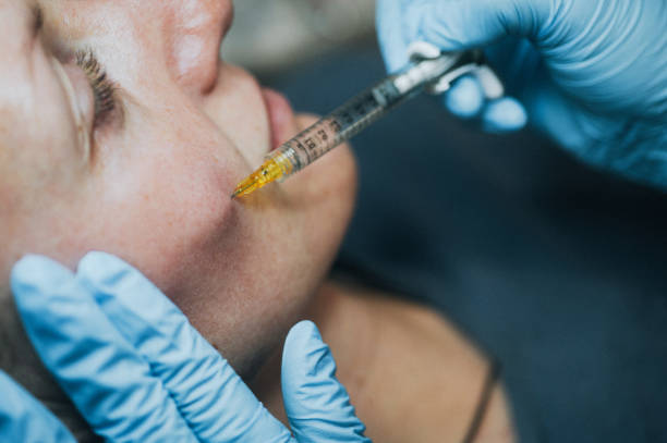 dermal fillers in Abu Dhabi