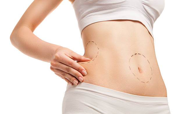 Vaser 4D liposuction in Abu Dhabi