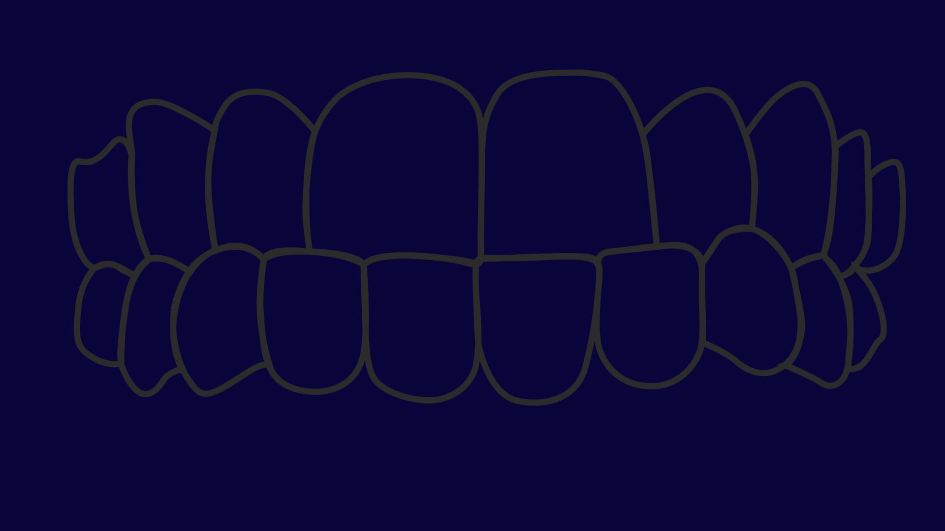 say-goodbye-to-underbite-your-guide-to-a-more-harmonious-smile
