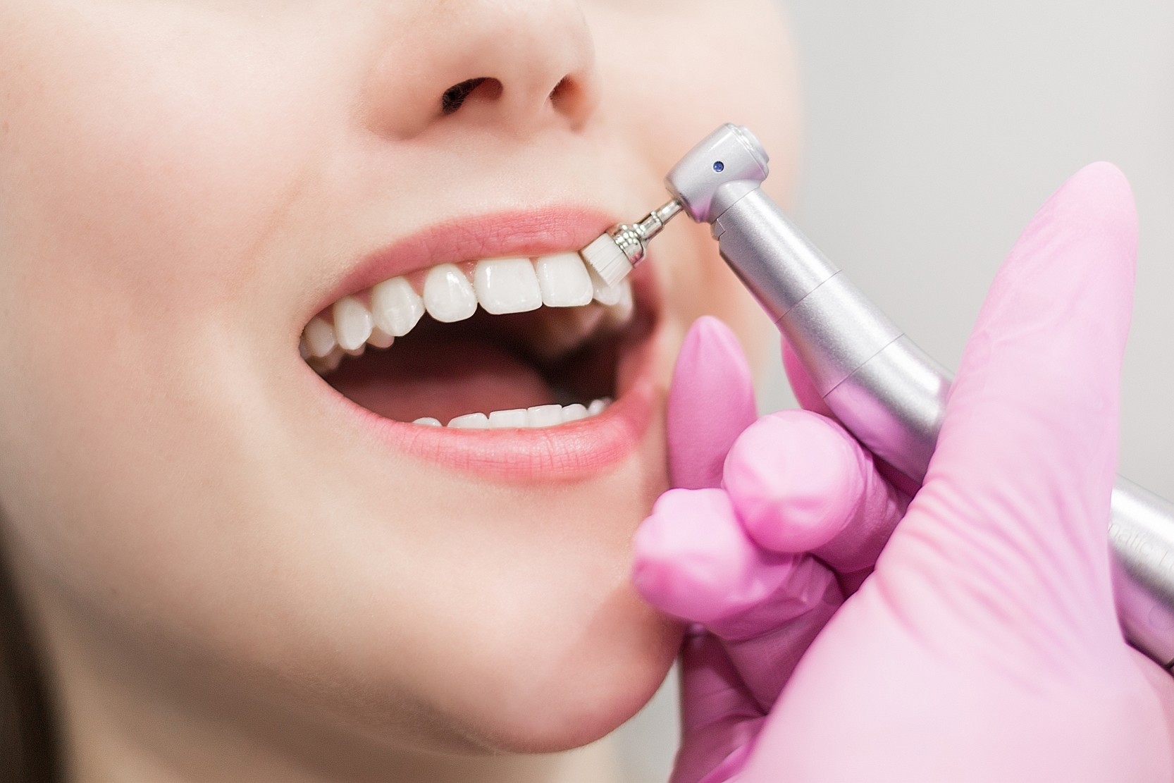 teeth cleaning cost in nandanvan