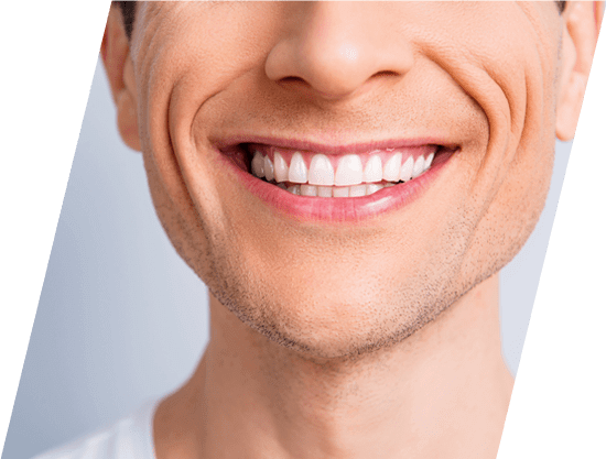 teeth whitening in dombivli