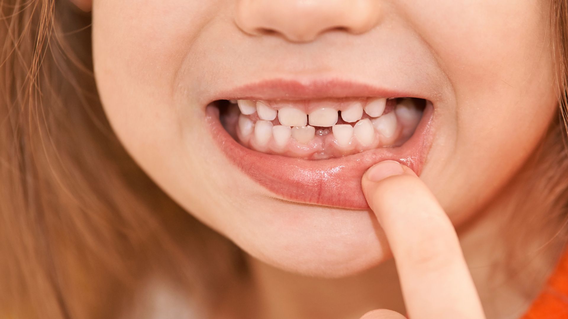 the-future-of-the-gap-teeth-trend