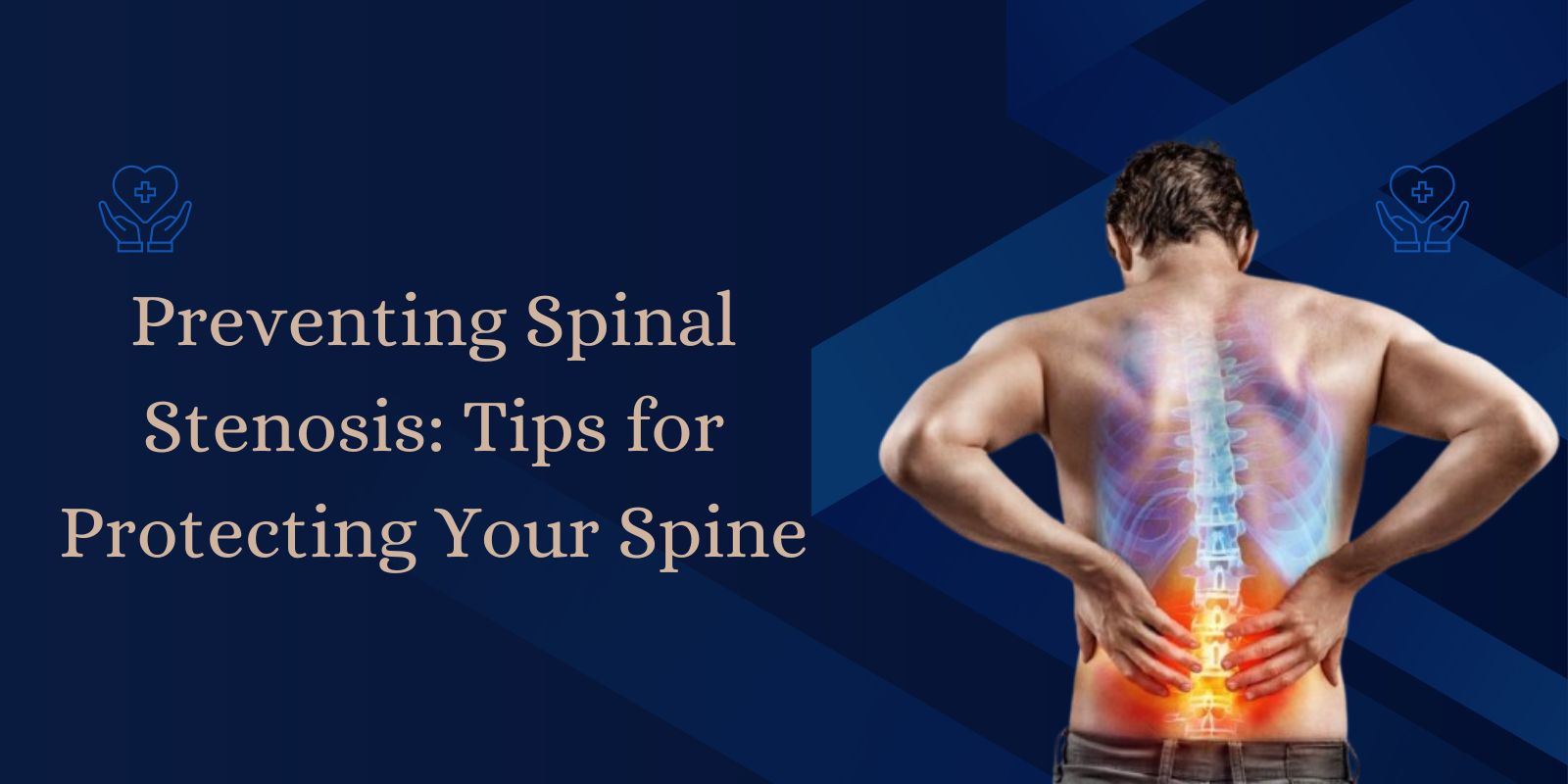 spinal stenosis cause