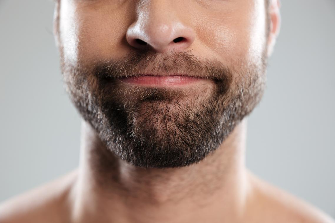 beard transplant in birmingham