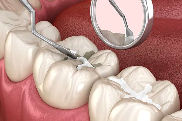Best Pediatric Dentist in chembur