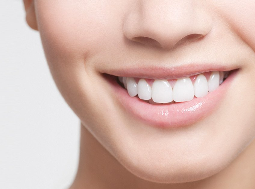 smile makeover cost in ghatkopar