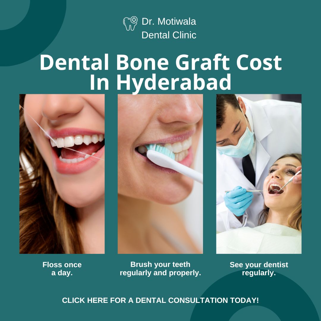 Dental Bone Graft Cost In Hyderabad