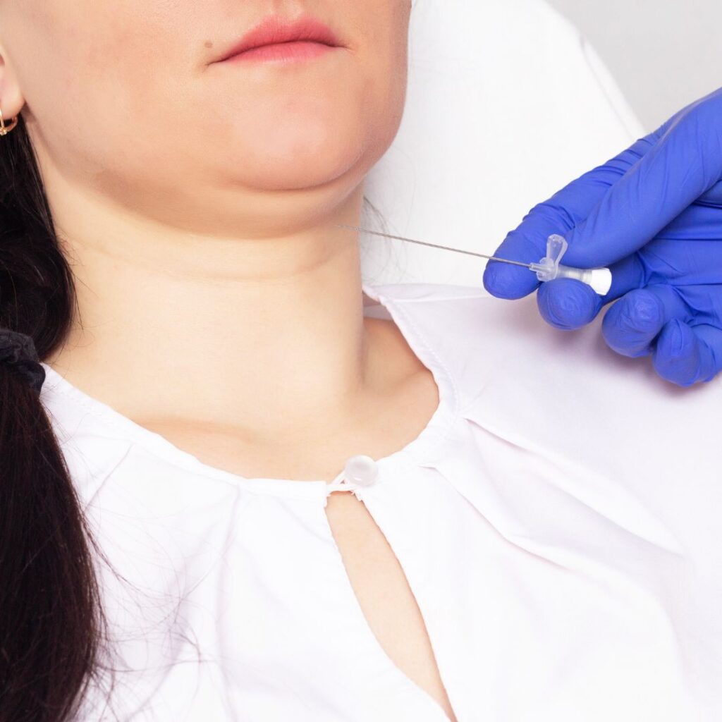 Double Chin Removal in Dubai