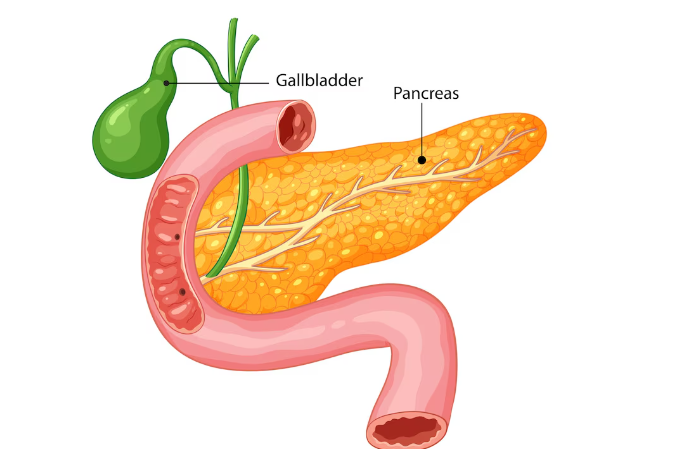 Galblader removal surgery in delhi