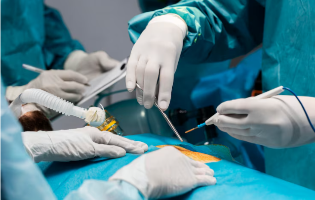 bariatric surgery in Delhi | Surgeon in Delhi