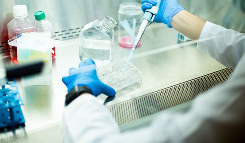 How to Choose the Right Mammalian Cell Line for Your Experiment