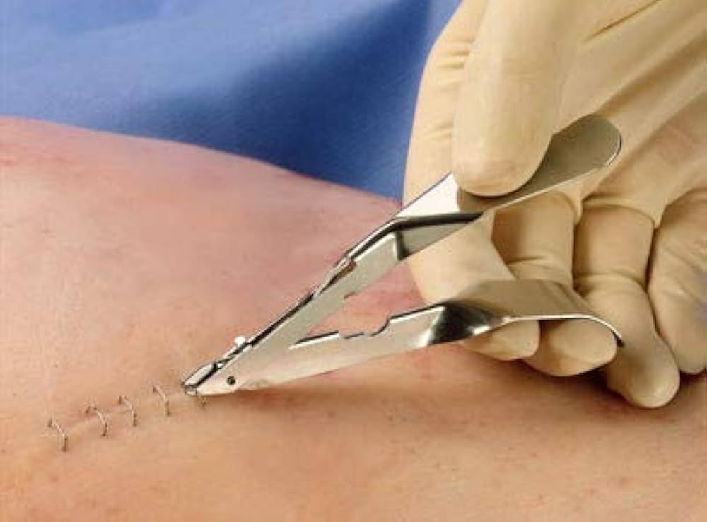 Medical Staplers