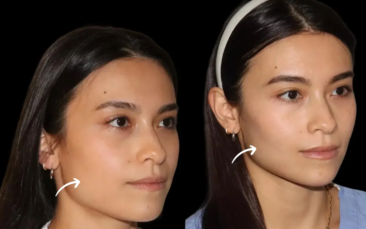 Best Plastic Surgeons in dubai
