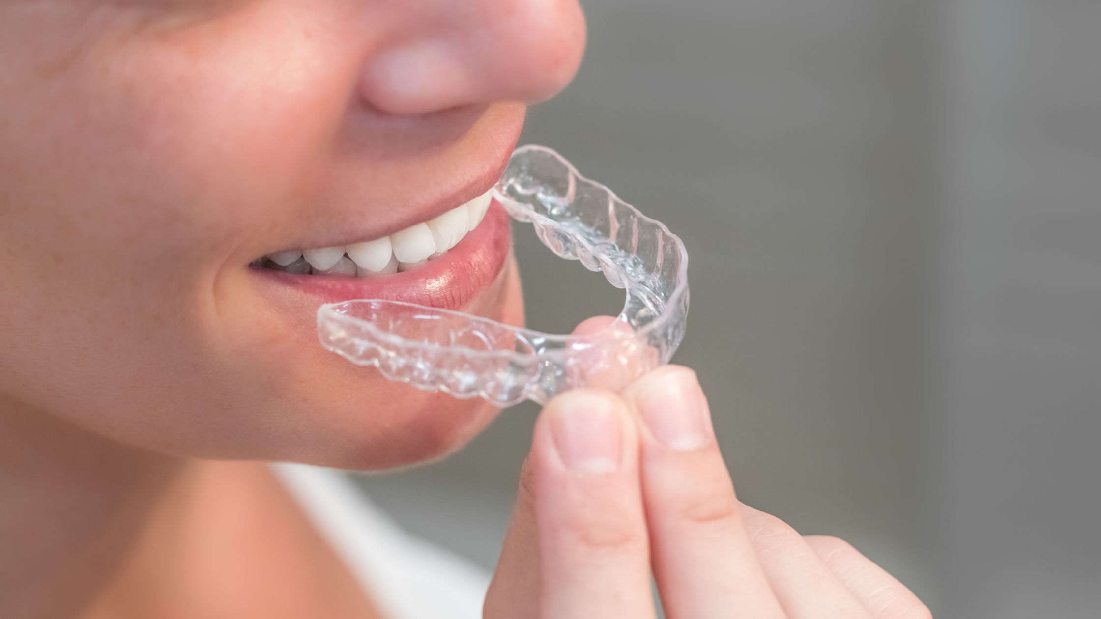 Are-Clear-Aligners-Effective-for-Severe-Dental-Issues-A-Detailed-Look