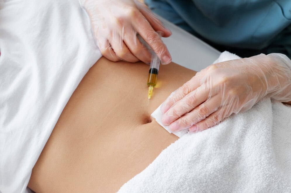 Fat Melting Injections vs. Liposuction Which Is Right for You