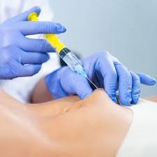 Fat dissolving needles in Dubai