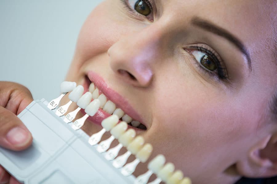 Fixing-Stains-and-Chips-The-Power-of-Veneers