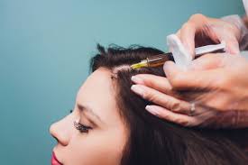 Plasma Injection for Hair in Dubai