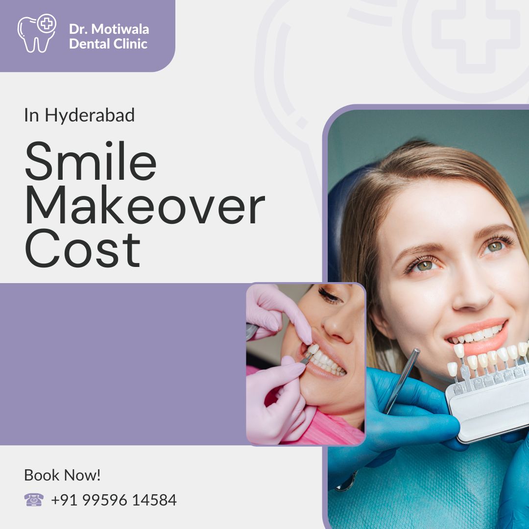 Smile Makeover Cost