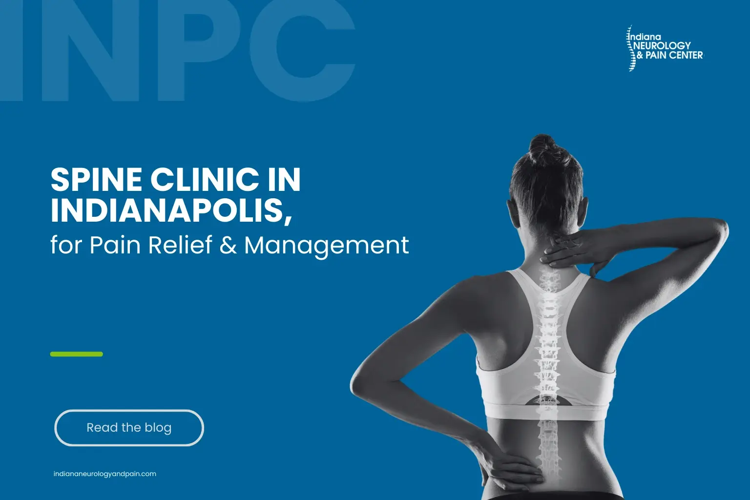 Spine Clinic in Indianapolis, for Pain Relief & Management