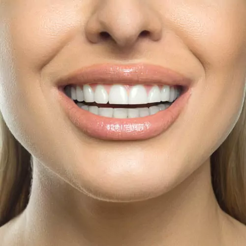 The Evolution of Teeth Whitening Past to Present