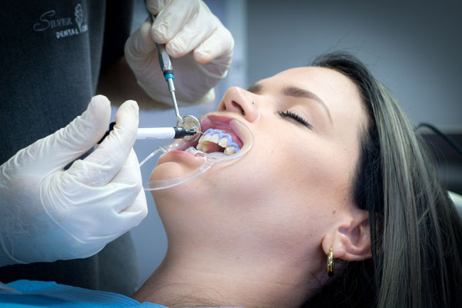 The Science of Teeth Whitening How Does It Really Work