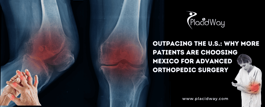 Why More Patients from the U.S. Are Opting for Orthopedic Surgery in Mexico
