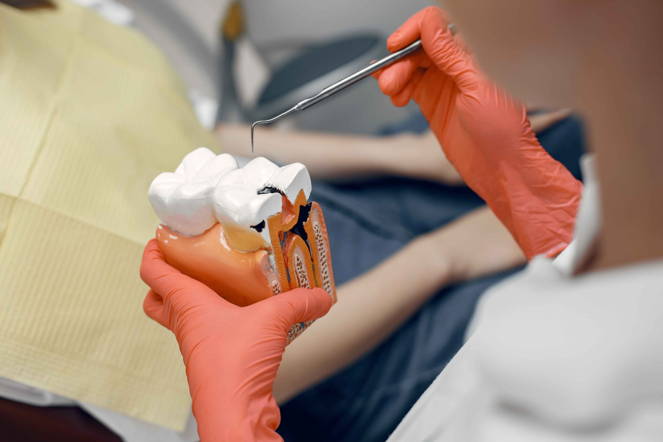Why root canal therapy is essential for saving damaged teeth