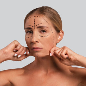 Best Facelift Surgery in Gurgaon