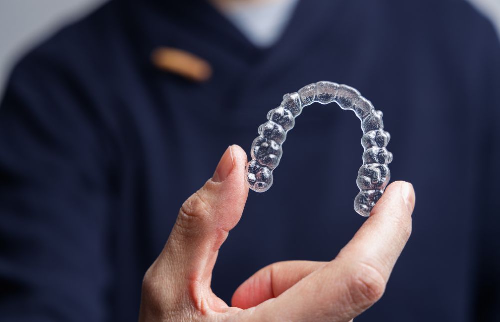 Aligners for Overbites Correcting Your Smile Invisibly