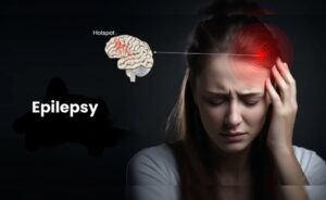 Best-Epilepsy-Specialist-In-Mumbai