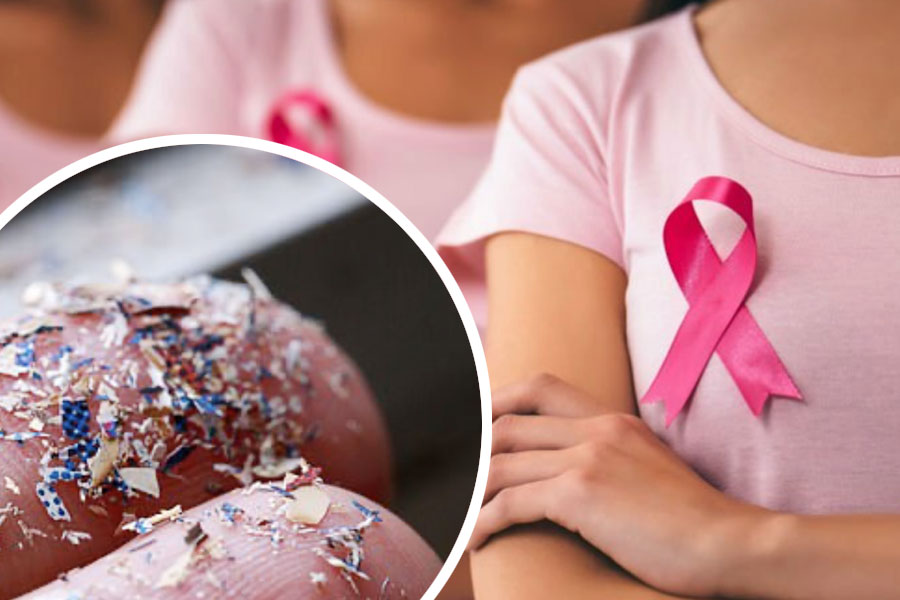 Breast cancer