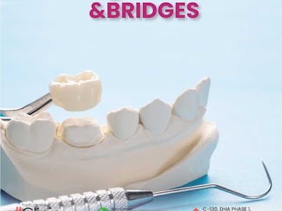 dental tooth implant