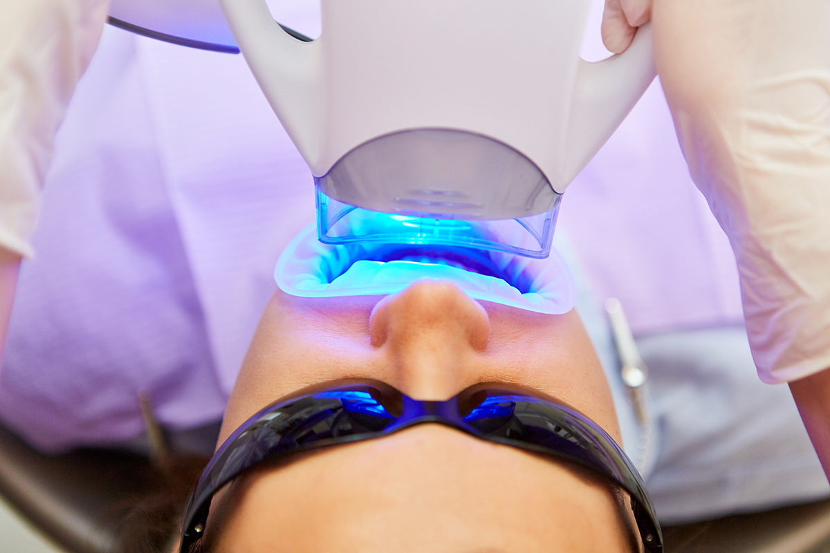 The Cost of Zoom Teeth Whitening Is It Worth the Investment