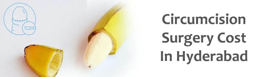 Circumcision-Surgery-Cost-In-Hyderabad (1)