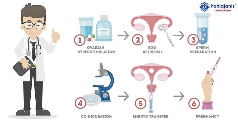 IVF Procedure